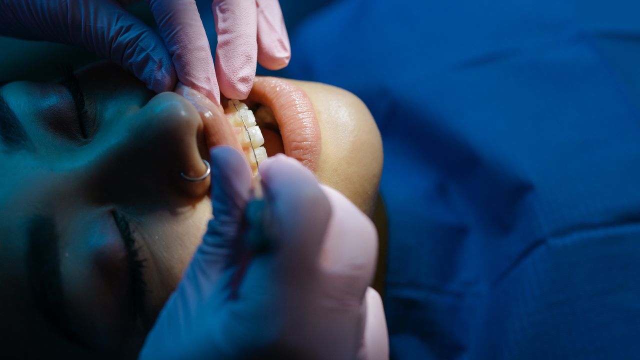 Ortodontista a colocar aparelho dentário num paciente numa clínica em Lisboa